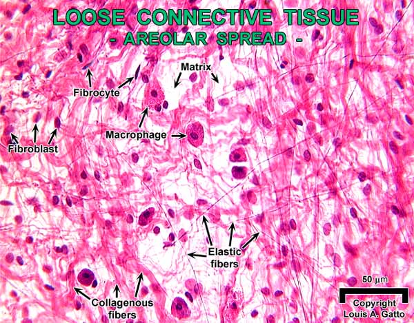 web.cortland.edu - /gatto/Histology/CTproper/images/