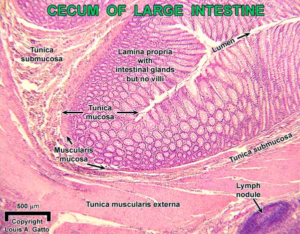 33-Cecum4x