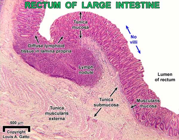 36-Rectum4x