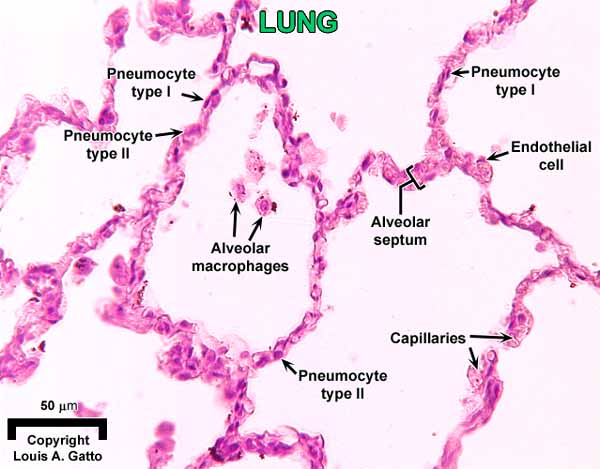 16-Lung1x40