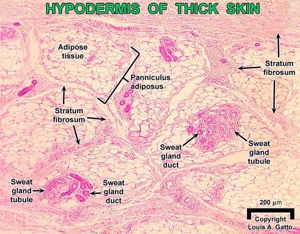 17-Hypo2x10