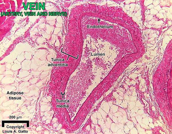 27-Vein10x