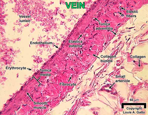 28-Vein1x40