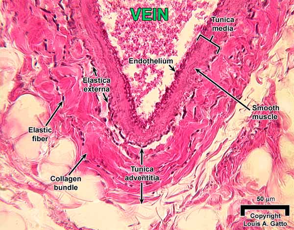 29-Vein2x40