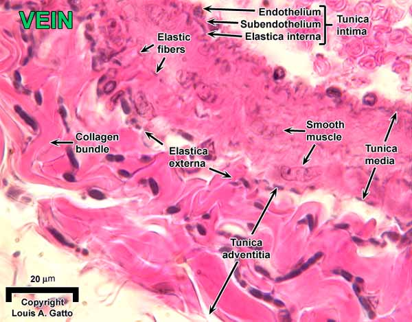 31-Vein1OIL